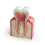 following root canal treatment