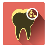 Cavities