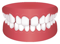 Gum disease