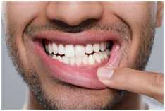 Assess your teeth and gums