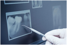 X-rays