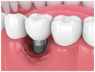 Aftercare and Recovery